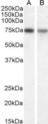 Western Blot: Choline Acetyltransferase/ChAT Antibody [NB100-40794] - Staining of mouse (A) and rat (B) brain lysate. Antibody at 1 ug/mL, 35 ug protein in RIPA buffer. Detected by chemiluminescence.