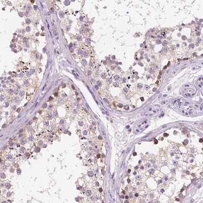 Immunohistochemistry-Paraffin: Chondrolectin Antibody [NBP1-86817] - Staining of human testis shows high expression.