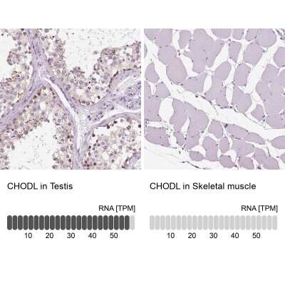 Immunohistochemistry-Paraffin: Chondrolectin Antibody [NBP1-86817] - Staining in human testis and skeletal muscle tissues using anti-CHODL antibody. Corresponding CHODL RNA-seq data are presented for the same tissues.