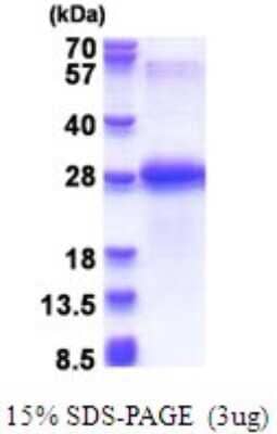 SDS-Page: Chondrolectin Recombinant Protein [NBP2-51693] - 15% SDS Page (3 ug)