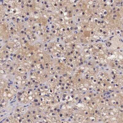 Immunohistochemistry-Paraffin: Chordin-like 1/CHRDL1 Antibody [NBP1-84486] - Staining of human parathyroid gland shows cytoplasmic positivity in glandular cells.