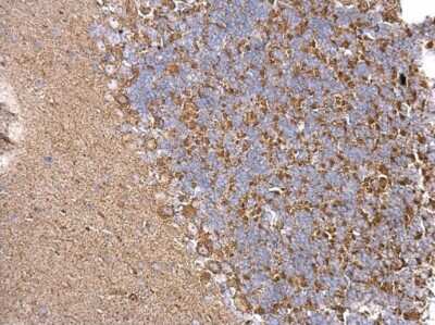 Immunohistochemistry-Paraffin: Chordin-like 1/CHRDL1 Antibody [NBP3-12874] - Chordin-like 1/CHRDL1 antibody detects Chordin-like 1/CHRDL1 protein at cytosol on mouse hind brain by immunohistochemical analysis. Sample: Paraffin-embedded mouse hind brain. Chordin-like 1/CHRDL1 antibody (NBP3-12874) dilution: 1:500. Antigen Retrieval: Trilogy(TM) (EDTA based, pH 8.0) buffer, 15min