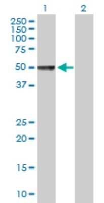 Western Blot: Chordin-like 1/CHRDL1 Antibody [H00091851-B01P] - Analysis of CHRDL1 expression in transfected 293T cell line by CHRDL1 polyclonal antibody.  Lane 1: CHRDL1 transfected lysate(49.5 KDa). Lane 2: Non-transfected lysate.