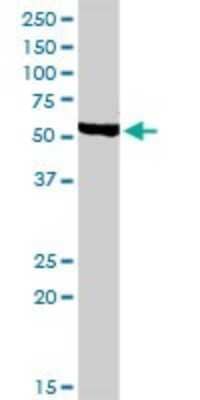 Western Blot: Chordin-like 1/CHRDL1 Antibody [H00091851-D01P] - Analysis of CHRDL1 expression in mouse kidney.