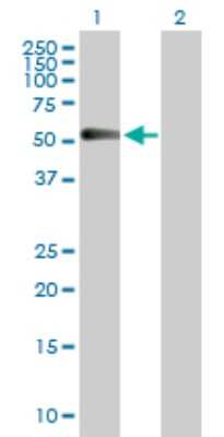 Western Blot: Chordin-like 1/CHRDL1 Antibody [H00091851-D01P] - Analysis of CHRDL1 expression in transfected 293T cell line by CHRDL1 polyclonal antibody.Lane 1: CHRDL1 transfected lysate(51.20 KDa).Lane 2: Non-transfected lysate.