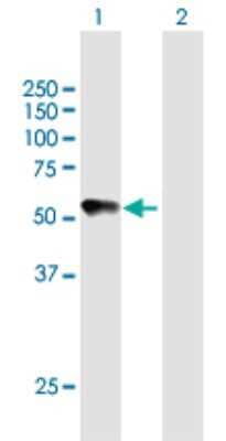 Western Blot: Chordin-like 2/CHRDL2 Antibody [H00025884-B01P] - Analysis of CHRDL2 expression in transfected 293T cell line by CHRDL2 polyclonal antibody.  Lane 1: CHRDL2 transfected lysate(49.61 KDa). Lane 2: Non-transfected lysate.