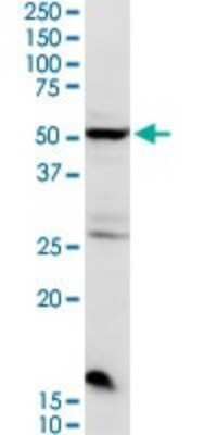 Western Blot: Chordin-like 2/CHRDL2 Antibody [H00025884-D01P] - Analysis of CHRDL2 expression in Jurkat.