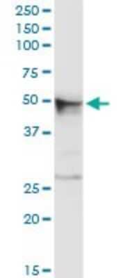 Western Blot: Chordin-like 2/CHRDL2 Antibody [H00025884-D01P] - Analysis of CHRDL2 expression in human kidney.