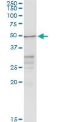 Western Blot: Chordin-like 2/CHRDL2 Antibody [H00025884-D01P] - Analysis of CHRDL2 expression in mouse testis.