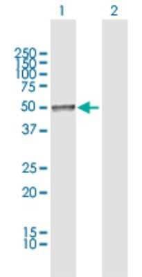 Western Blot: Chordin-like 2/CHRDL2 Antibody [H00025884-D01P] - Analysis of CHRDL2 expression in transfected 293T cell line by CHRDL2 polyclonal antibody.Lane 1: CHRDL2 transfected lysate(49.61 KDa).Lane 2: Non-transfected lysate.
