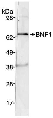 Western Blot: Chordin-like 2/CHRDL2 Antibody [NB100-2319] - Whole cell lysate (50 ug) from DU145 cells. Antibody used at 3 ug/ml.