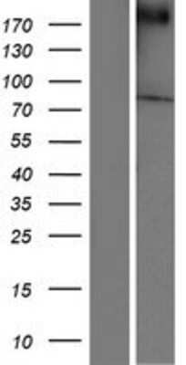 Western Blot: Chorein Overexpression Lysate (Adult Normal) [NBP2-05897] Left-Empty vector transfected control cell lysate (HEK293 cell lysate); Right -Over-expression Lysate for Chorein.