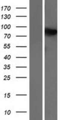 Western Blot: Chorein Overexpression Lysate (Adult Normal) [NBP2-10296] Left-Empty vector transfected control cell lysate (HEK293 cell lysate); Right -Over-expression Lysate for Chorein.