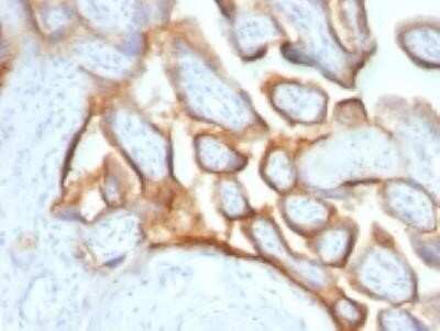 Immunohistochemistry-Paraffin: Chorionic Gonadotropin alpha Chain (hCG alpha) Antibody (SPM552) - IHC-Prediluted [NBP2-45136] - Formalin-fixed, paraffin-embedded placenta stained with hCG alpha Ab (SPM552). Note specific membrane staining.