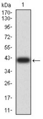 Western Blot Chorionic Gonadotropin beta Chain (hCG beta) Antibody (4B8B3) - BSA Free