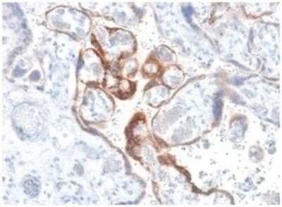 Immunohistochemistry-Paraffin: Chorionic Gonadotropin beta Chain (hCG beta) Antibody (HCGb/1985R) [NBP3-07497] - Formalin-fixed, paraffin-embedded human placenta stained with Chorionic Gonadotropin beta Chain (hCG beta) Rabbit Recombinant Monoclonal Antibody (HCGb/1985R).