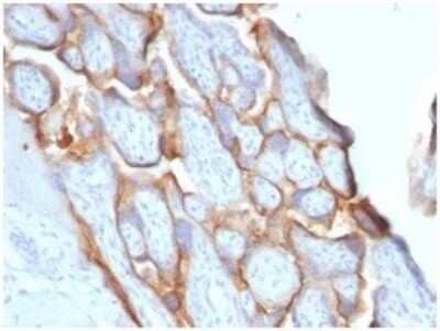 Immunohistochemistry-Paraffin: Chorionic Gonadotropin beta Chain (hCG beta) Antibody (HCGb/1996R) - Azide and BSA Free [NBP3-08821] - Formalin-fixed, paraffin-embedded human placenta stained with Chorionic Gonadotropin beta Chain (hCG beta) Antibody (HCGb/1996R).