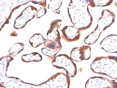 Immunohistochemistry-Paraffin: Chorionic Gonadotropin beta Chain (hCG beta) Antibody (HCGb/459) [NBP2-34237] - Formalin-fixed, paraffin-embedded human placenta stained with hCG beta MAb (HCGb/459). Note specific membrane staining.