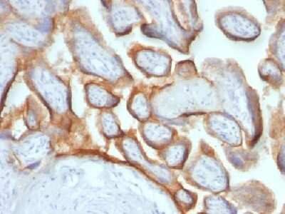 Immunohistochemistry-Paraffin Chorionic Gonadotropin beta Chain (hCG beta) Antibody (HCGb/54+ HCGb/459)