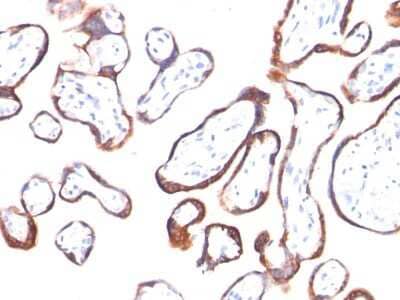 Immunohistochemistry-Paraffin: Chorionic Gonadotropin beta Chain (hCG beta) Antibody (HCGb/54) [NBP2-22392] - Formalin-fixed, paraffin-embedded placenta stained with hCG beta Ab (HCGb/54). Note specific membrane staining.