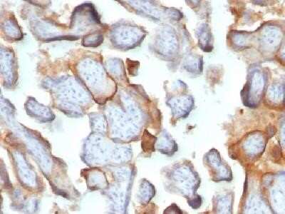 Immunohistochemistry-Paraffin: Chorionic Gonadotropin beta Chain (hCG beta) Antibody (SPM105) - Azide and BSA Free [NBP2-34392] - Formalin-fixed paraffin-embedded human placenta stained with hCG beta Monoclonal Antibody (SPM105)