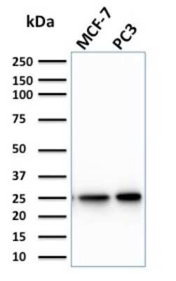Western Blot: Chp2 Antibody (CPTC-CHP2-1) - Azide and BSA Free [NBP3-08694] - Western Blot Analysis of MCF-7 & PC3 cell lysates using Chp2 Mouse Monoclonal Antibody (CPTC-CHP2-1).