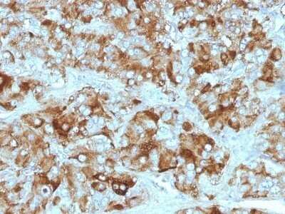 Immunohistochemistry-Paraffin: Chromogranin A Antibody (CGA/413 + CHGA/777 + CHGA/798) - Azide and BSA Free [NBP2-47846] - Adrenal Gland stained with Chromogranin A Monoclonal Antibody (CGA/413+ CHGA/777+ CHGA/798)