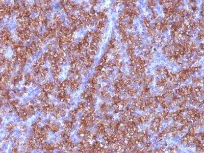 Immunohistochemistry-Paraffin: Chromogranin A Antibody (CGA/413) - Azide and BSA Free [NBP2-47850] - Human Parathyroid stained with Chromogranin A Monoclonal Antibody (CGA/413)