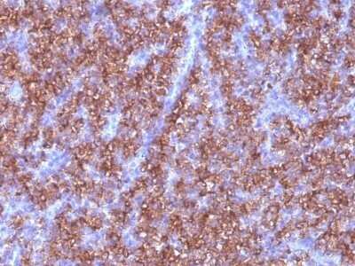 Immunohistochemistry-Paraffin: Chromogranin A Antibody (CGA/413) - IHC-Prediluted [NBP2-48081] - Human Parathyroid stained with Chromogranin A Monoclonal Antibody (CGA/413)