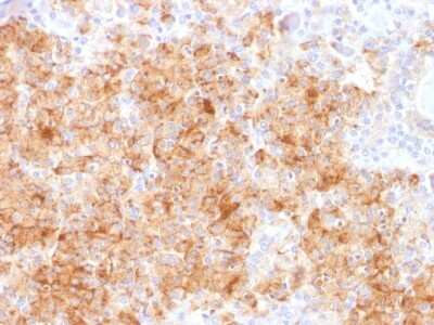 Immunohistochemistry-Paraffin: Chromogranin A Antibody (CHGA/1731R) - Azide and BSA Free [NBP2-54316] - Formalin-fixed, paraffin-embedded human Parathyroid stained with Chromogranin A Recombinant Rabbit Monoclonal Antibody (CHGA/1731R)