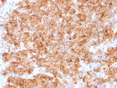 Immunohistochemistry-Paraffin: Chromogranin A Antibody (CHGA/1773R) - Azide and BSA Free [NBP2-54382] - Formalin-fixed, paraffin-embedded human Parathyroid stained with Chromogranin A Recombinant Rabbit Monoclonal Antibody (CHGA/1773R)