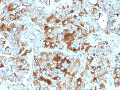 Immunohistochemistry-Paraffin: Chromogranin A Antibody (CHGA/765) [NBP2-44773] - Human Adrenal Gland stained with Chromogranin A Monoclonal Antibody (CHGA/765)