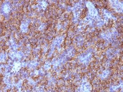 Immunohistochemistry-Paraffin: Chromogranin A Antibody (CHGA/765) [NBP2-44773] - Human Parathyroid stained with Chromogranin A Monoclonal Antibody (CHGA/765)
