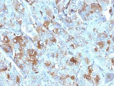 Immunohistochemistry-Paraffin: Chromogranin A Antibody (CHGA/777) - Azide and BSA Free [NBP2-47848] - Human Adrenal Gland stained with Chromogranin A Monoclonal Antibody (CHGA/777)