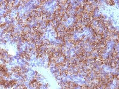 Immunohistochemistry-Paraffin: Chromogranin A Antibody (CHGA/798) - IHC-Prediluted [NBP2-48072] - Human Parathyroid stained with Chromogranin A Monoclonal Antibody (CHGA/798)