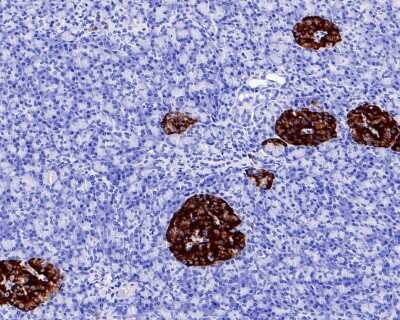 Immunohistochemistry-Paraffin: Chromogranin A Antibody (JM103-7) [NBP2-66780] - Analysis of paraffin-embedded human pancreas tissue with Rabbit anti-Chromogranin A antibody washed with ddH2O and PBS, and then probed with the primary antibody  at 1/200 dilution for 1 hour at room temperature. The detection was performed using an HRP conjugated compact polymer system. DAB was used as the chromogen. Tissues were counterstained with hematoxylin and mounted with DPX.