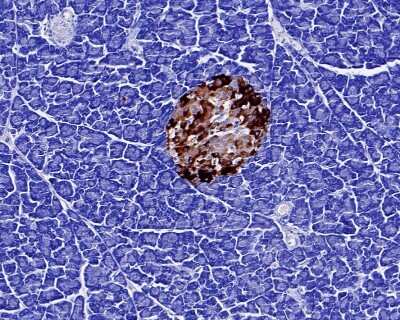 Immunohistochemistry-Paraffin: Chromogranin A Antibody (JM103-7) [NBP2-66780] - Analysis of paraffin-embedded rat pancreas tissue with Rabbit anti-Chromogranin A antibody washed with ddH2O and PBS, and then probed with the primary antibody  at 1/200 dilution for 1 hour at room temperature. The detection was performed using an HRP conjugated compact polymer system. DAB was used as the chromogen. Tissues were counterstained with hematoxylin and mounted with DPX.