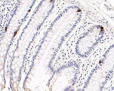 Immunohistochemistry-Paraffin: Chromogranin A Antibody (JM103-7) [NBP2-66780] - Analysis of paraffin-embedded human colon tissue with Rabbit anti-Chromogranin A antibody. The section was pre-treated using heat mediated antigen retrieval with Tris-EDTA buffer (pH 9.0) for 20 minutes. The tissues were blocked in 1% BSA for 20 minutes at room temperature, washed with ddH2O and PBS, and then probed with the primary antibody000 dilution for 1 hour at room temperature. The detection was performed using an HRP conjugated compact polymer system. DAB was used as the chromogen. Tissues were counterstained with hematoxylin and mounted with DPX.