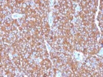 Immunohistochemistry-Paraffin: Chromogranin A Antibody (LK2H10 + PHE5 + CGA/414) - Azide and BSA Free [NBP2-34674] - Formalin-fixed, paraffin-embedded human Adrenal Gland stained with Chromogranin A Monoclonal Antibody (LK2H10=PHE5+CGA414)