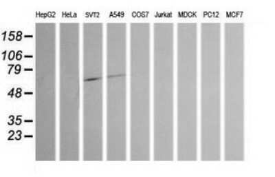 Western Blot: Chromogranin A Antibody (OTI2E12) - Azide and BSA Free [NBP2-70410] - Analysis of extracts (35ug) from 9 different cell lines by using CHGA monoclonal antibody (HepG2: human; HeLa: human; SVT2: mouse; A549: human; COS7: monkey; Jurkat: human; MDCK: canine; PC12: rat; MCF7: human).