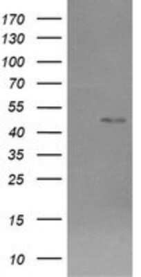 Western Blot: Chromogranin A Antibody (OTI2E12) - Azide and BSA Free [NBP2-70410] - Analysis of HEK293T cells were transfected with the pCMV6-ENTRY control (Left lane) or pCMV6-ENTRY Chromogranin A.