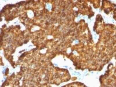 Immunohistochemistry-Paraffin: Chromogranin A Antibody (SPM553) - IHC-Prediluted [NBP2-44766] - Formalin-fixed, paraffin-embedded human pancreas stained with chromograninn A Monoclonal Antibody (SPM553)