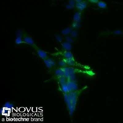 Immunocytochemistry/Immunofluorescence: Chromogranin A Antibody (SPM553) [NBP2-32955] - SHSY5Y cells were fixed for 10 minutes using 10% formalin and then permeabilized for 5 minutes using 1X PBS + 0.05% Triton-X100.  The cells were incubated with anti-Chromogranin A conjugated to Alexa Fluor 488 [NBP2-34795AF488] at 10ug/ml for 1 hour at room temperature.  Nuclei were counterstained with DAPI (Blue).  Cells were imaged using a 40X objective. Image from the Alexa Fluor 488 version of this antibody.