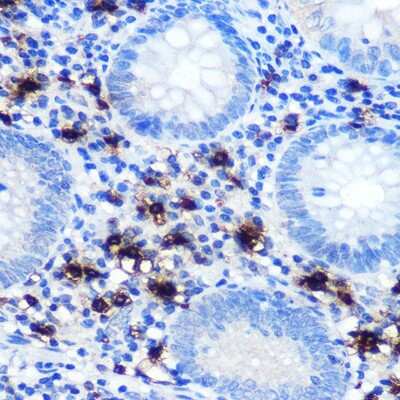 Immunohistochemistry-Paraffin: Chymase/CMA1/Mast Cell Chymase Antibody (2O4P8) [NBP3-15389] - Human appendix using Chymase/CMA1/Mast Cell Chymase (CMA1) Rabbit mAb (NBP3-15389) at dilution of 1:100 (40x lens).Perform microwave antigen retrieval with 10 mM PBS buffer pH 7.2 before commencing with IHC staining protocol.