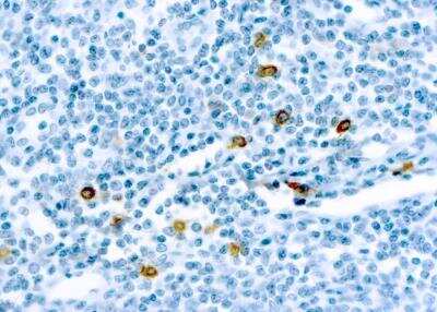 Immunohistochemistry: Chymase/CMA1/Mast Cell Chymase Antibody (CC1) [NB100-693] - Staining of a human tonsil cross section