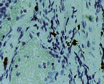 Immunohistochemistry-Paraffin: Chymase/CMA1/Mast Cell Chymase Antibody (CC1) [NB100-693] - Formalin fixed paraffin embedded human tonsil stained with Mast Cell Chymase antibody.