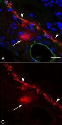 <b>Orthogonal Strategies Validation. </b>Immunocytochemistry/Immunofluorescence: Chymase/CMA1/Mast Cell Chymase Antibody [NBP2-33660] - Aged control whole mount choroid immunolabeled for (A) UEA lectin (blue), (B) tryptase (red), and (C) chymase (green). The vast majority of human choroidal MCs are of the MCT phenotype (tryptase+/chymase-). Only a small percentage of MCs are MCtc (tryptase+/chymase+) (arrows). Scale bar: 30 um. Image collected and cropped by CiteAb from the following publication (//iovs.arvojournals.org/article.aspx?doi=10.1167/iovs.17-22989), licensed under a CC-BY license.