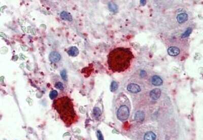 Immunohistochemistry-Paraffin: Chymase/CMA1/Mast Cell Chymase Antibody [NBP1-52386] - Analysis of anti-Mast Cell Chymase antibody with human testis, mast cells at concentration 1.5 ug/ml.
