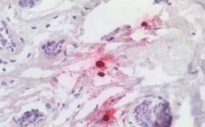 Immunohistochemistry-Paraffin: Chymase/CMA1/Mast Cell Chymase Antibody [NBP1-52386] - Immunohistochemical analysis of formalin-fixed, paraffin-embedded human breast tissue.