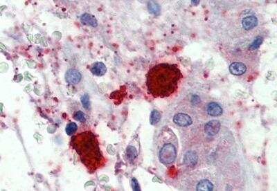 Immunohistochemistry-Paraffin: Chymase/CMA1/Mast Cell Chymase Antibody [NBP2-27551] - Staining of paraffin embedded Human Testis (Mast cells). Antibody at 1.5 ug/mL. Steamed antigen retrieval with citrate buffer pH 6, AP-staining.